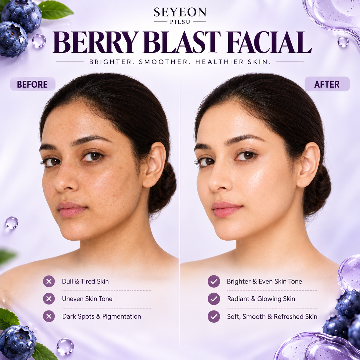 Berry Blast Ice Cream Facial Kit